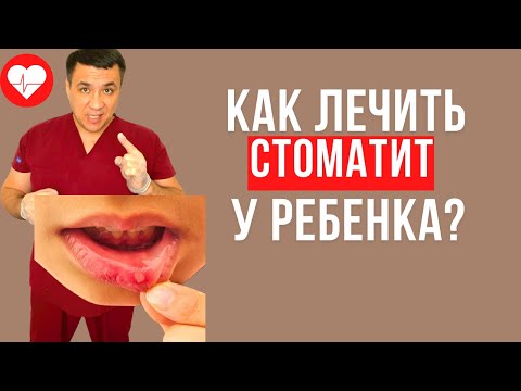 Как лечить стоматит у детей?Смотри описание к видео.