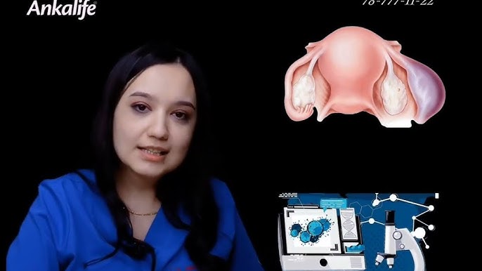 Yaxshi sifatli porno tomosha Eng chiroyli trans porno aktrisalar reytingi