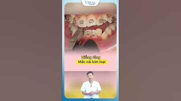 Quy Trình Gắn Mắc Cài Niềng Răng Từ A - Z | Bác Sĩ Yên