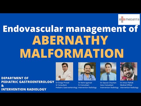 Endovascular treatment of Abernathy Malformation, Medanta Lucknow