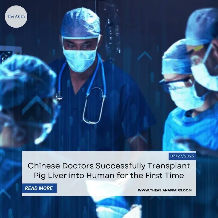 Download lagu Chinese Doctors Successfully Transplant Pig Liver into Human for the First Time