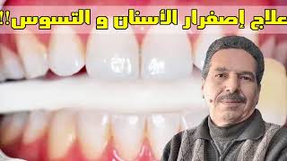 علاج إصفرار الأسنان و التسوس!! معجون أسنان طبيعي دون مكونات ضارة!! مع الدكتور جمال الصقلي