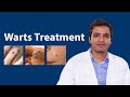 Wart treatment: Wart Removal Treatment on face,hands,fingers,genitals and feet | Wart removal creams