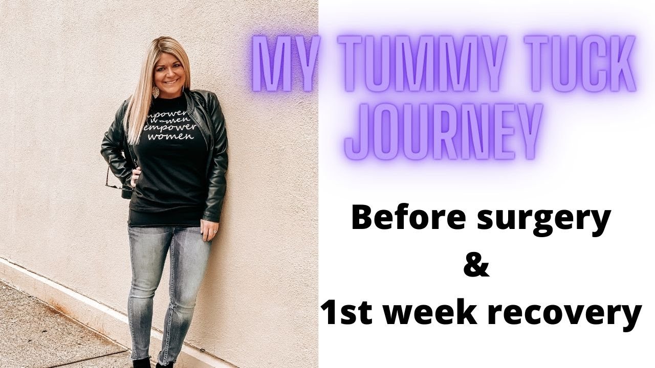 my tummy tuck journey