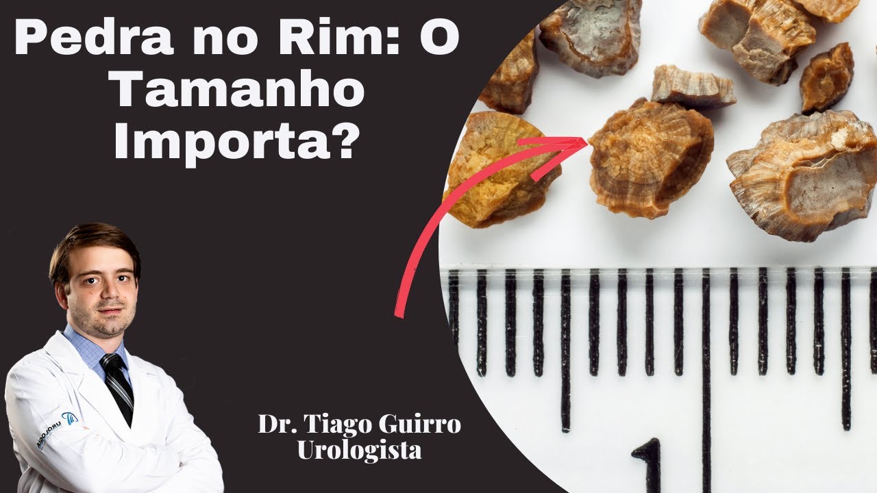 Pedra no Rim: O Tamanho Importa?