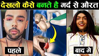 लडक स लडक बनन क सरजर कस क जत ह Male To Female Gender Change Surgery Process