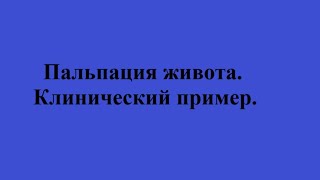 Пальпация живота. Клинический пример