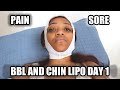 SURGERY DAY!!!!! *BBL & CHIN LIPO*