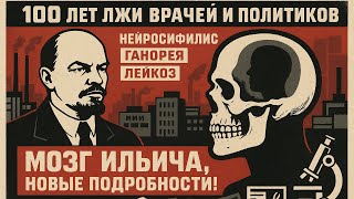 МОЗГ ЛЕНИНА: сифилис, гонорея или аномалия? Где Ильич это подхватил