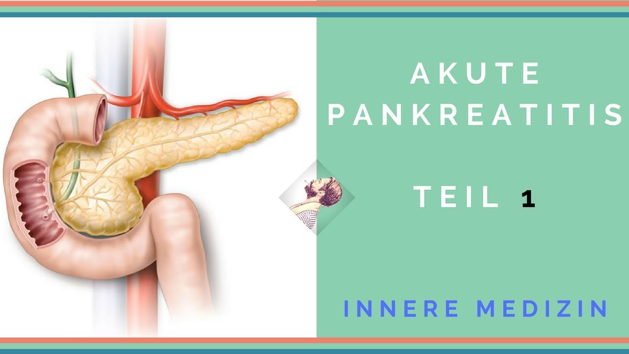 Innere Medizin: Akute Pankreatitis - Teil 1 - YouTube
