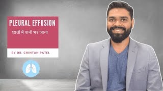 Pleural Effusion Causes, Signs & Treatment By  Dr Chintan Shankar Patel