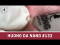 #132 | Huong Da Nang
