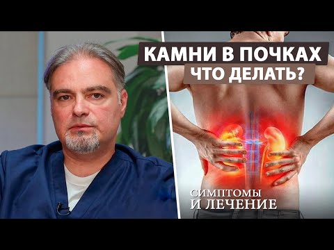 Видео: 3 способа отхождения камня в почках