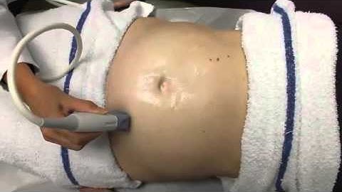 Ultrasound in Obstetrics & Gynecology: A Practical Approach - Clip 10.7