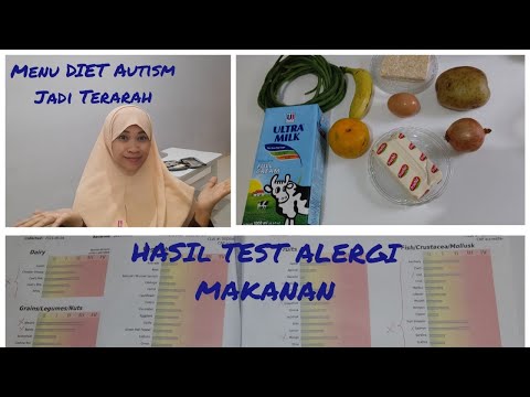 Hasil Lab Test Alergi Makanan ||Terapi Biomedis||