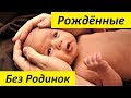 Почему у Новорожденных Нет Родинок?