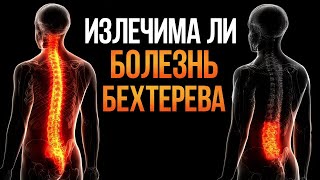 видео: ИЗЛЕЧИМА ЛИ БОЛЕЗНЬ БЕХТЕРЕВА? Ревматолог Людмила Шорникова картинка: ИЗЛЕЧИМА ЛИ БОЛЕЗНЬ БЕХТЕРЕВА? Ревматолог Людмила Шорникова