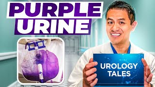 Urology Story Time | Purple Urine