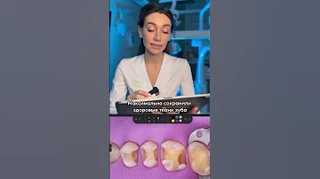 👩‍⚕️  Кариес под пломбами! Клинический случай Belgravia Dental Studio