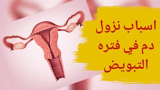 ما أسباب نزول دم في فترة التبويض؟