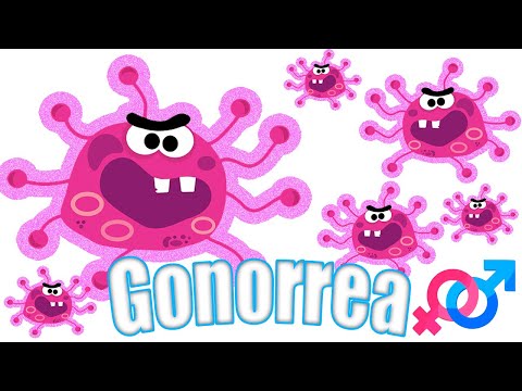 Vídeo: Tratamiento De La Gonorrea Con Remedios Y Métodos Populares