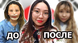 ПРЕОБРАЖЕНИЕ В КОРЕЕ! ДО И ПОСЛЕ ПЛАСТИЧЕСКИХ ОПЕРАЦИЙ!|NikyMacAleen