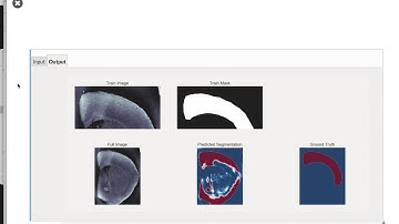 QBI Lecture 6: Shape Analysis, Part 1