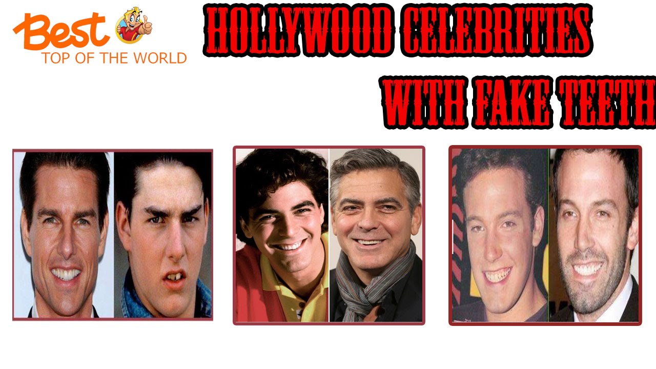 Best Top of The world Hollywood Celebrities with Fake Teeth - YouTube