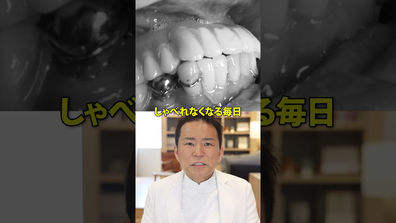 One more tooth lost and you'll need full dentures