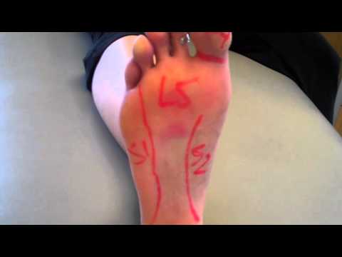 Foot Nerve Pain: Can it come from your Low Back?