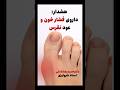 داروی فشارخون و عود نقرس