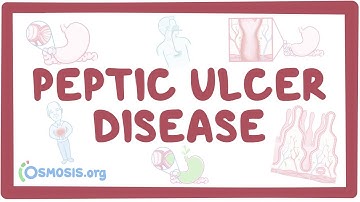 Peptic ulcer disease - causes, symptoms, diagnosis, treatment, pathology