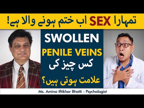 Nafs Ki Ragon Ka Ubhar Jana | Swollen Penile Veins: Is It Dangerous? | Must Watch For Men