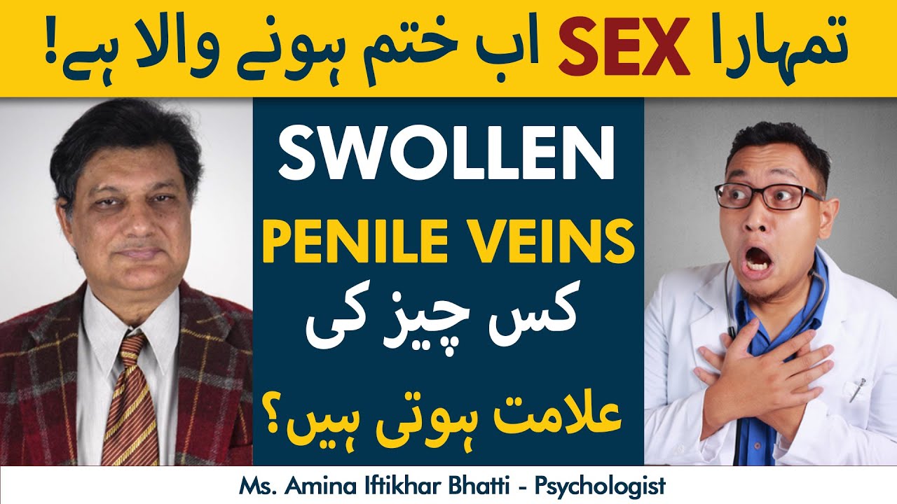 Nafs Ki Ragon Ka Ubhar Jana  Swollen Penile Veins Is It Dangerous  Must Watch For Men