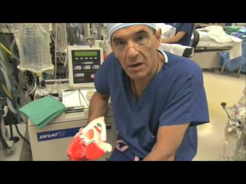 Heart Valve Replacement Surgery Explained Part 1