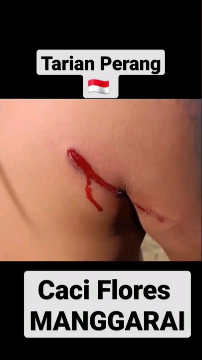 Tari Caci / Tarian Perang  Manggarai || Budaya Lokal Nusantara NTT 🇮🇩#shorts