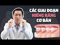 Các Giai Đoạn Niềng Răng Cơ Bản Ai Cũng Cần Biết