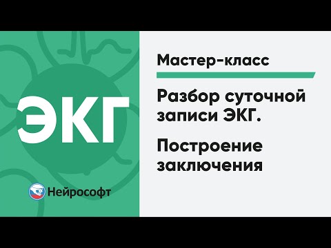 Разбор суточной записи ЭКГ. Построение заключения | Мастер-класс