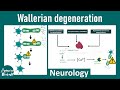 Neurology | Nerve Injury &amp; Repair: Wallerian Degeneration. Injury induces axon degeneration