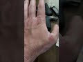 Medical Prep Monday - Liquid Skin