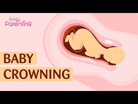 Baby Crowning During Birth - Everything You Need to Know