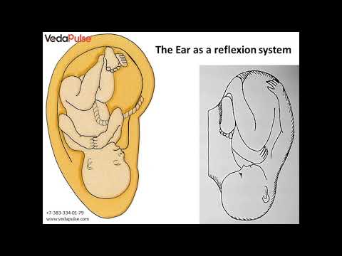 Auriculotherapy همانطور که هست و به عنوان یک ماژول نرم افزاری توسط VedaPulse