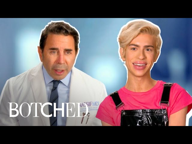 REJECTED By Botched: The Sugar Baby With "Pillow Lips" | Botched | E!