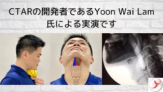 (Japanese) Dysphagia Swallowing Exercise - Chin Tuck Against Resistance with Ball by CTAR Inventor