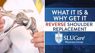 What Is A Reverse Shoulder Replacement? - SLUCare Orthopedic Surgery