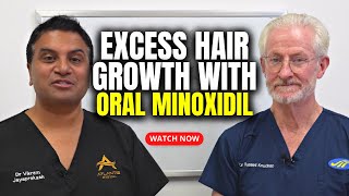 Excess Hair Growth with Oral Minoxidil