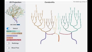 CerebroVis: An Abstract yet Spatially Contextualized Cerebral Artery Network Visualization