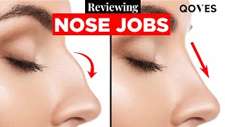 Some Of These Nose Jobs Are...