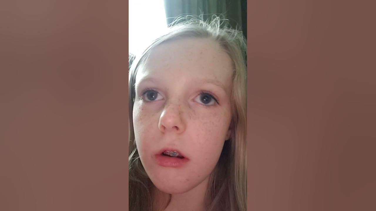 I Got Braces My Lips Feel Weird YouTube i-got-braces-my-lips-feel-weird-youtube