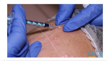 Botox Training - How to Inject Botox